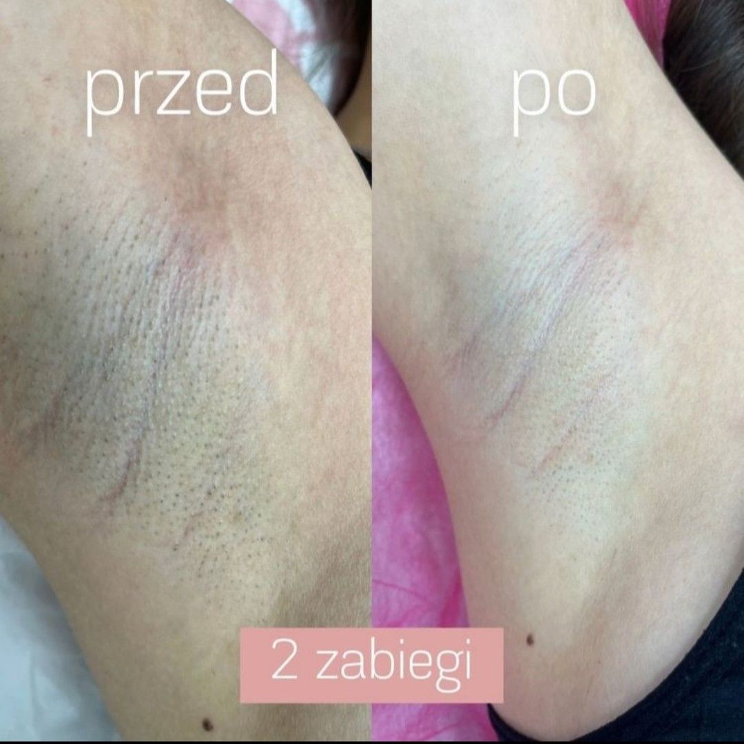 Wnętrze salonu Luna Laser